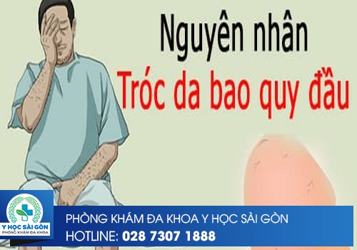 Bao Quy Đầu Bị Bong Tróc Da: Nguyên Nhân Và Điều Trị