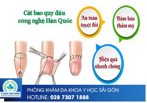 cắt bao quy đầu công nghệ Hàn Quốc