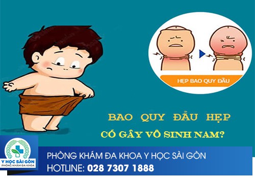 Bao Quy Đầu Hẹp Có Gây Vô Sinh Nam?