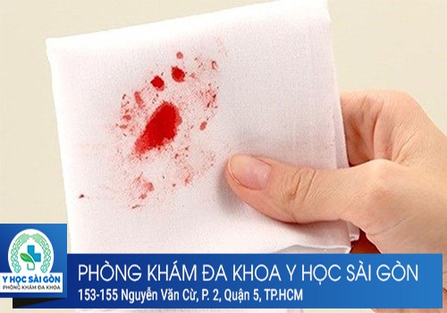 ⚕️ Nguyên Nhân Đi Cầu Ra Máu Đỏ Tươi Là Gì