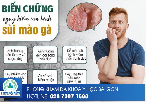 Biến chứng nguy hiểm bệnh sùi mào gà 