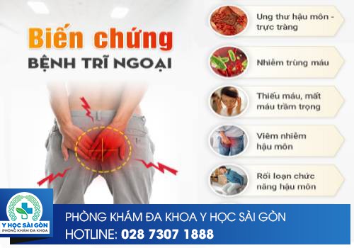 Mức Độ Nguy Hiểm Của Trĩ Ngoại Độ 2