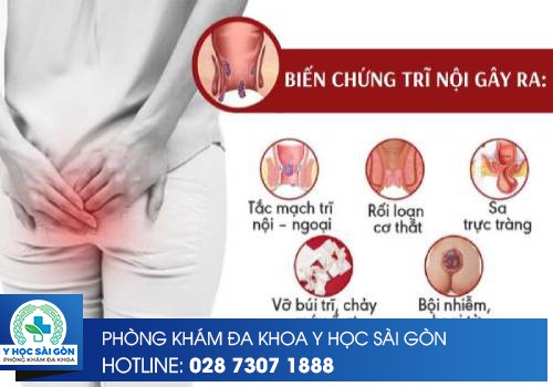 Những Biến Chứng Của Trĩ Nội Ít Ai Ngờ Đến