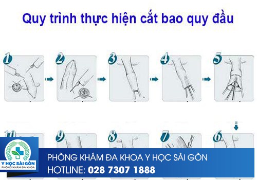 quy trình cắt bao quy đầu