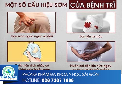 dấu hiệu trĩ ngoại độ 1