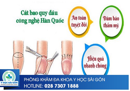 cắt bao quy đầu hàn quốc