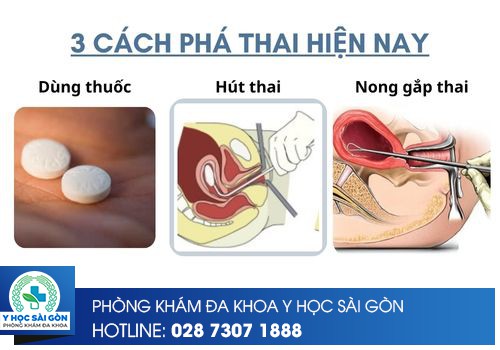 3 cách phá thai hiện nay