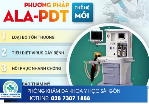 phương pháp ala-pdt điều trị sùi mào gà