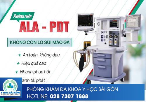 phương pháp ALA-PDT điều trị sùi mào gà