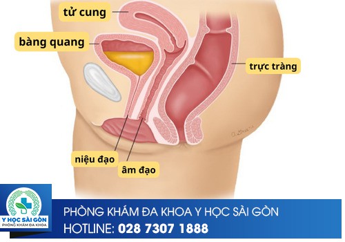 vị trí bàng quang và tử cung