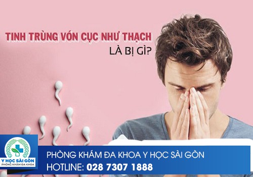 Tinh Trùng Vón Cục Như Thạch Là Dấu Hiệu Gì?