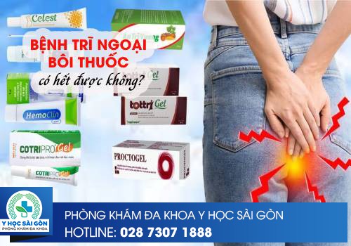 Trĩ Ngoại Bôi Thuốc Có Hết Được Không?