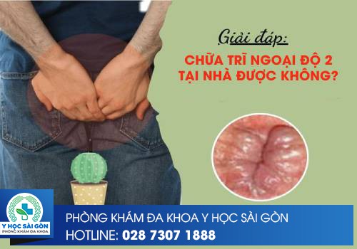 Chữa Trĩ Ngoại Độ 2 Tại Nhà Có Được Không?