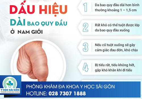 Triệu Chứng Dài Bao Quy Đầu Cần Điều Trị Sớm