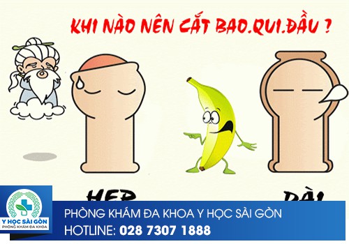 Tự Cắt Bao Quy Đầu Tại Nhà Có Nên Hay Không?